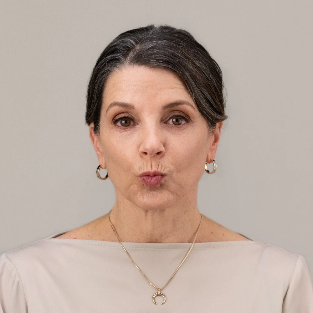 Cathy Front Pucker Before 100 percent